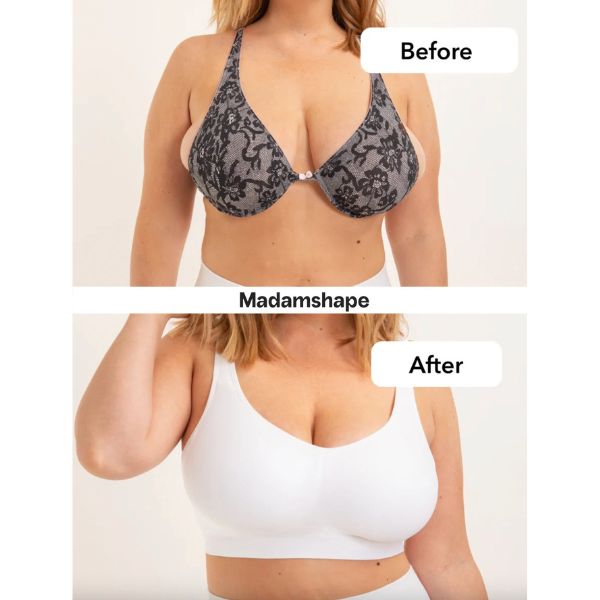 UPFORMA
